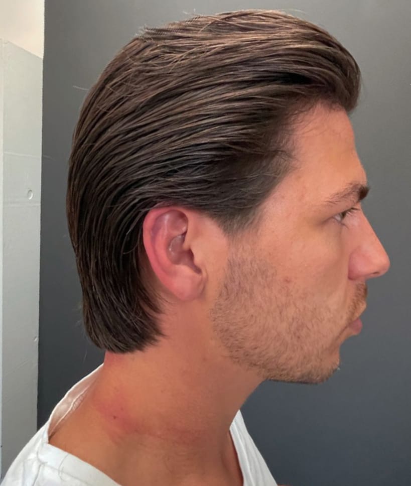 barbier2